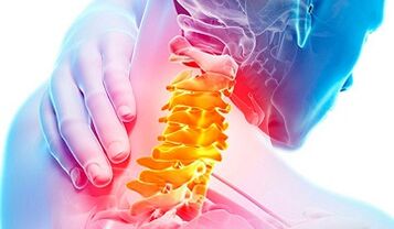 A nyaki gerinc osteokondrózisának jelei