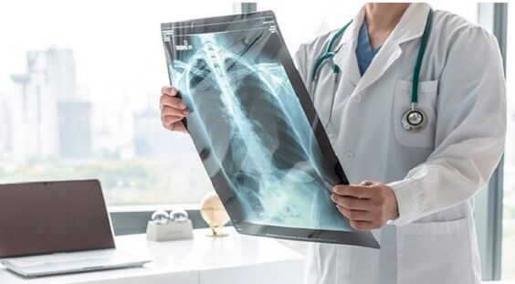A bal lapocka alatti fájdalom röntgendiagnosztikája