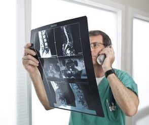 Mielográfia az osteochondrosis és az intervertebralis herniák diagnosztizálására