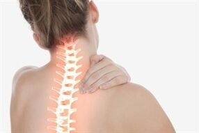 Nyaki osteochondrosis egy nőben